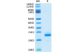 IL-4 Protein (AA 25-153)