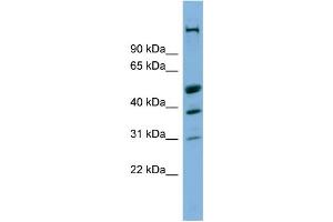 WB Suggested Anti-CREBZF Antibody Titration:  0.