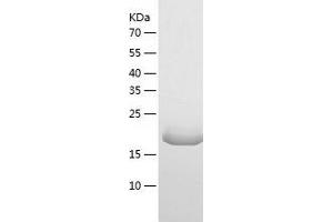 Western Blotting (WB) image for Leukemia Inhibitory Factor (LIF) (AA 24-203) protein (His tag) (ABIN7123758)