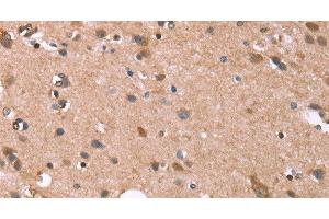 Immunohistochemistry (Paraffin-embedded Sections) (IHC (p)) image for anti-Glypican 6 (GPC6) antibody (ABIN7243337)