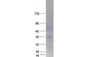 Validation with Western Blot (LEPROTL1 Protein (Transcript Variant 1) (Myc-DYKDDDDK Tag))