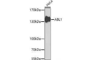 Western blot analysis of extracts of HeLa cells using ABL1 Polyclonal Antibody at dilution of 1:1000. (ABL1 Antikörper)