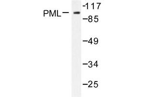 Image no. 1 for anti-Promyelocytic Leukemia (PML) antibody (ABIN271787) (PML Antikörper)