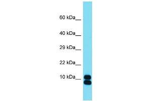Host: Rabbit  Target Name: Rpl35  Sample Tissue: Mouse Small Intestine lysates  Antibody Dilution: 1.