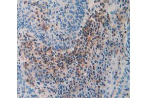 Used in DAB staining on fromalin fixed paraffin- embedded Kidney tissue (THBS3 Antikörper  (AA 670-921))