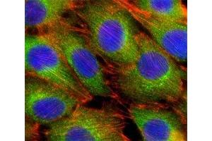 Fluorescent confocal image of C2C12 cells stained with AKT2 antibody at 1:25. (AKT2 Antikörper  (AA 416-444))