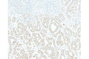 Immunohistochemistry (IHC) image for anti-Jun Dimerization Protein 2 (JDP2) (AA 50-100) antibody (ABIN7795635) (Rekombinanter JDP2 Antikörper  (AA 50-100))