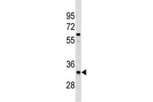 Western Blotting (WB) image for anti-X-Ray Repair Complementing Defective Repair in Chinese Hamster Cells 4 (XRCC4) (AA 205-234) antibody (ABIN3029650)