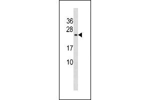 CUTA Antibody (C-term) (ABIN1881242 and ABIN2843290) western blot analysis in 293 cell line lysates (35 μg/lane).