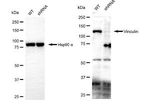 Western blotting analysis using vinculin antibody (ABIN7800841).