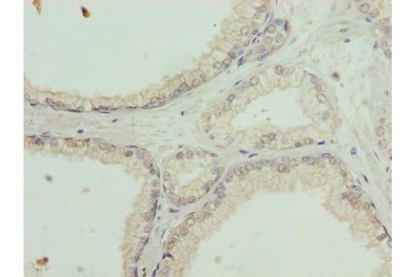SLC31A2 antibody  (AA 44-93)
