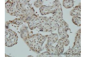 Image no. 1 for anti-Cullin-Associated and Neddylation-Dissociated 1 (CAND1) (AA 1-101) antibody (ABIN599270) (CAND1 Antikörper  (AA 1-101))