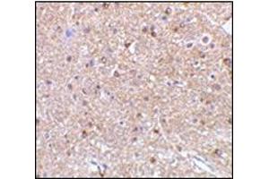 Immunohistochemistry of NogoA in mouse brain tissue with this product at 2.