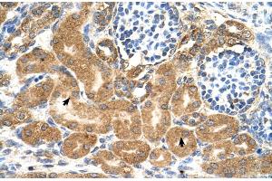 Human kidney (TMEM69 Antikörper  (Middle Region))