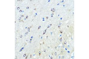 Immunohistochemistry of paraffin-embedded mouse brain using FUT4 Rabbit pAb (ABIN7267274) at dilution of 1:100 (40x lens). (CD15 Antikörper  (AA 200-300))