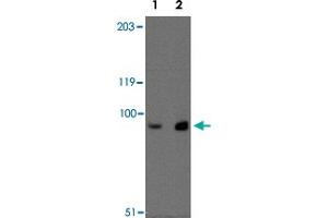 Western blot analysis of MEX3D in MDA-MB-361 cell lysate with MEX3D polyclonal antibody  at (Lane 1) 1 ug/mL and (Lane 2) 2 ug/mL . (MEX3D Antikörper  (Internal Region))