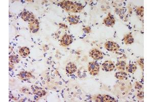 Formalin-fixed and paraffin embedded human kidney labeled with Anti-PBEF1 Polyclonal Antibody, Unconjugated  at 1:200 followed by conjugation to the secondary antibody and DAB staining.