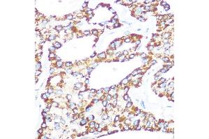 Immunohistochemistry (IHC) image for anti-Junction Plakoglobin (JUP) antibody (ABIN1683043)