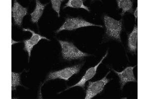 Immunofluorescent staining of HeLa (ATCC CCL-2) cells. (GRB2 Antikörper  (AA 1-217))