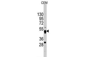 Western blot analysis of GATA4 polyclonal antibody  in CEM cell line lysates (35 ug/lane).