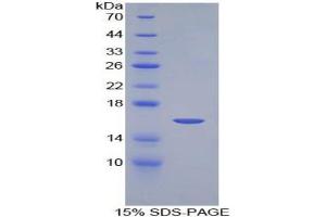 SDS-PAGE analysis of Mouse NRARP Protein.