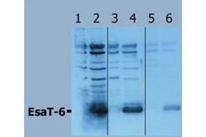 Western Blotting (Mycobacterium Tuberculosis Antigen EsaT-6 (Rv3875) Antikörper)