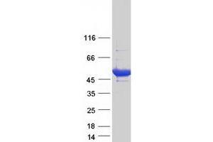 Western Blotting (WB) image for Thymidine Phosphorylase (TYMP) (Transcript Variant 2) protein (Myc-DYKDDDDK Tag) (ABIN2733621)