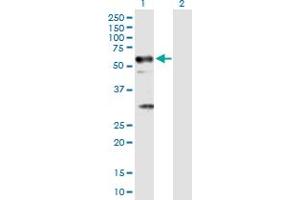 Western Blot analysis of TRAF6 expression in transfected 293T cell line by TRAF6 MaxPab polyclonal antibody. (TRAF6 Antikörper  (AA 1-522))