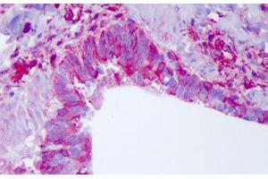 Human Lung: Formalin-Fixed, Paraffin-Embedded (FFPE) (NLRP11 Antikörper  (C-Term))