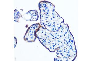 Immunohistochemistry of paraffin-embedded human placenta using IKKε Rabbit mAb (ABIN7267875) at dilution of 1:100 (40x lens). (IKKi/IKKe Antikörper)