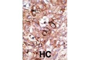 Immunohistochemistry (IHC) image for anti-BCL2-Associated Agonist of Cell Death (BAD) (BH3 Domain) antibody (ABIN2997223) (BAD Antikörper  (BH3 Domain))