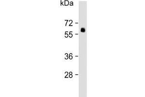 Western blot testing of human lung lysate with SMAD6 antibody.