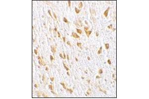 Immunohistochemistry (Paraffin-embedded Sections) (IHC (p)) image for anti-ArfGAP with GTPase Domain, Ankyrin Repeat and PH Domain 2 (AGAP2) (C-Term) antibody (ABIN500501)