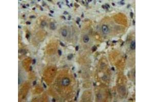 Used in DAB staining on fromalin fixed paraffin-embedded Liver tissue (DGKG Antikörper  (AA 451-698))