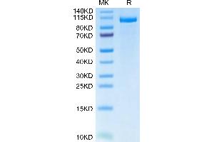 Human LRP-5 on Tris-Bis PAGE under reduced condition. (LRP5 Protein (AA 644-1263) (Fc Tag))