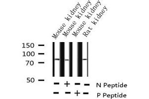 Western blot analysis of Phospho-C-RAF (Ser338) expression in various lysates