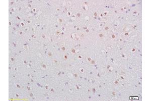 Formalin-fixed and paraffin embedded rat brain labeled with Anti-BDNF Polyclonal Antibody, Unconjugated (ABIN1387788) at 1:200 followed by conjugation to the secondary antibody and DAB staining. (BDNF Antikörper  (AA 151-247))