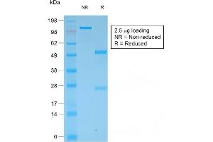SDS-PAGE Analysis Purified Multi-Cytokeratin Rabbit Monoclonal Antibody (KRT/1877R). (Rekombinanter Cytokeratin, Multi (Epithelial Marker) Antikörper)