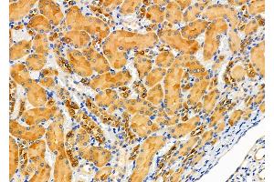ABIN6257300 and ABIN6275375 at 1/100 staining Rat kidney tissue by IHC-P.