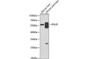 Western blot analysis of extracts of various cell lines, using PNLIP antibody (ABIN6128521, ABIN6145838, ABIN6145840 and ABIN6222025) at 1:1000 dilution. (PNLIP Antikörper  (AA 166-465))