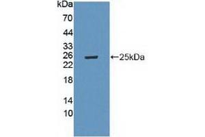 Western blot analysis of recombinant Mouse LAMa4. (LAMa4 Antikörper  (AA 745-940))