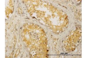 Immunoperoxidase of monoclonal antibody to CDC42BPB on formalin-fixed paraffin-embedded human testis. (CDC42BPB Antikörper  (AA 1580-1679))