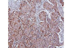 IHC analysis of HSPH1 using anti-HSPH1 antibody (ABIN7602237). (HSPH1 Antikörper  (AA 653-858))