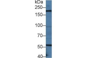 Detection of LAMb2 in Mouse Small intestine lysate using Polyclonal Antibody to Laminin Beta 2 (LAMb2) (LAMB2 Antikörper  (AA 1498-1716))