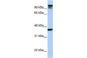 WB Suggested Anti-EPS15  Antibody Titration: 0. (EPS15 Antikörper  (C-Term))