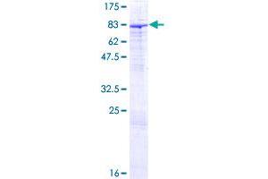 ZNF189 Protein (AA 1-584) (GST tag)