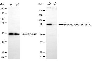 Western blotting analysis using phospho-NAK/TBK1 (S172) antibody (ABIN7800504). (Rekombinanter TBK1 Antikörper  (pSer172))