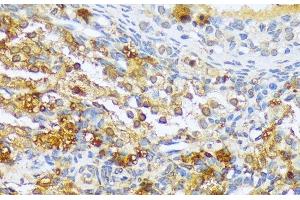 Immunohistochemistry of paraffin-embedded Rat ovary using A1CF Polyclonal Antibody at dilution of 1:100 (40x lens). (A1CF Antikörper)