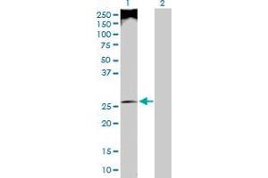 Lane 1: UBE2U transfected lysate ( 26.