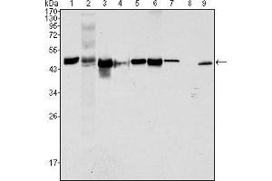 Western blot analysis using CK18 mouse mAb against Hela (1), NIH/3T3 (2), A549 (3), Jurkat (4), MCF-7(5), HepG2 (6), A431 (7), HEK293 (8) and K562 (9) cell lysate. (Cytokeratin 18 Antikörper  (AA 391-483))